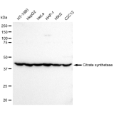 KD-Validated Citrate Synthetase Rabbit mAb (20 μl)