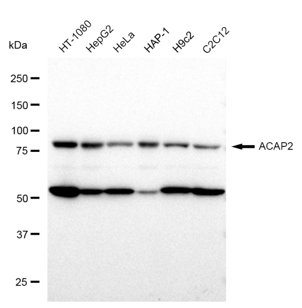 ACAP2 Rabbit mAb