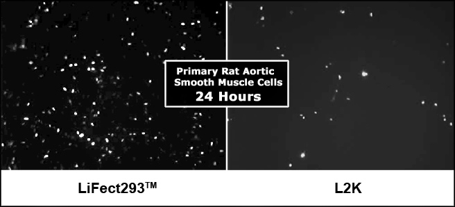 transfection reagent