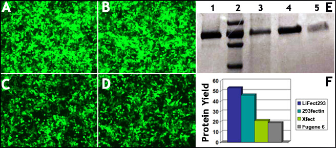 293 cells transfection