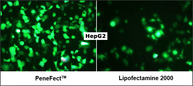 Fluorescence microscopy of HepG2 cells transfected with PeneFect showing high GFP expression and healthy morphology.
