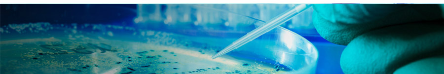 Bacterial Protein Expression